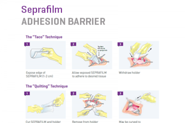 Seprafilm QRG 